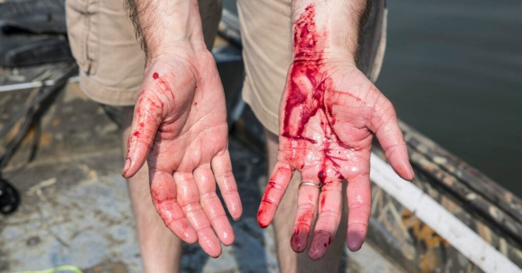 bloody hands from shooting invasive carp
