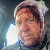 Tom Sommer survived a mauling by a grizzly bear