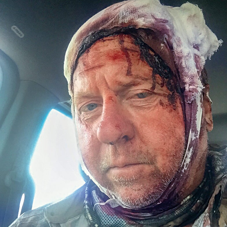 Tom Sommer survived a mauling by a grizzly bear