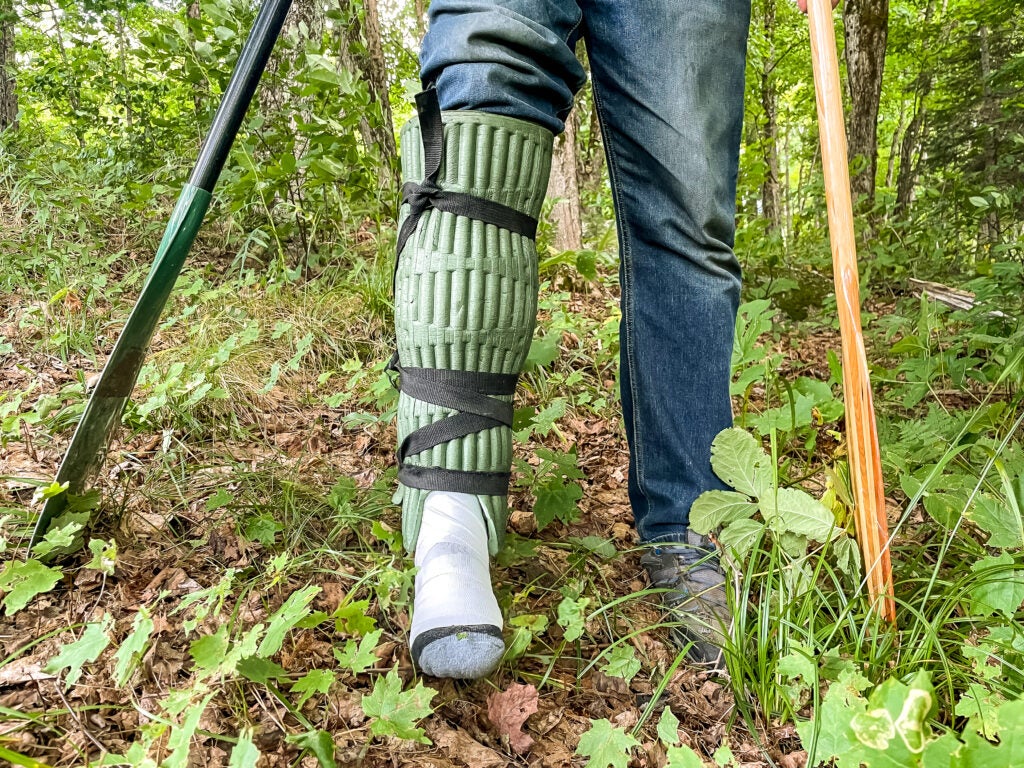 how to treat sprained ankle in the outdoors