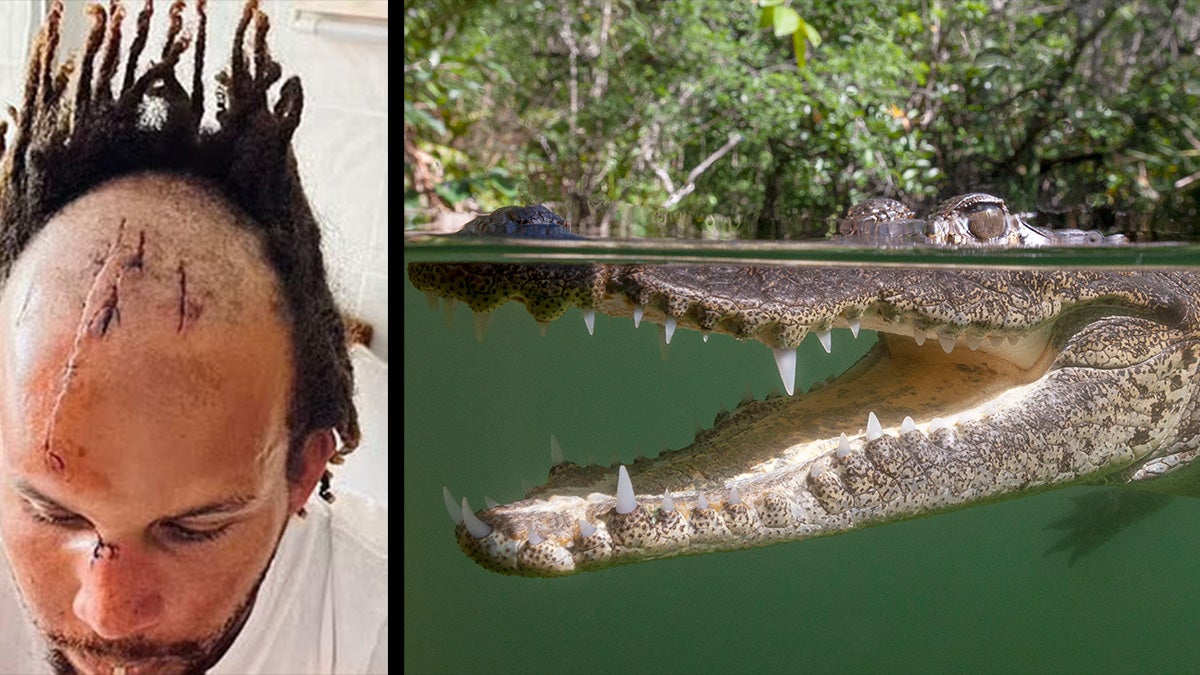 crocodile with jaws open and man with scars on head