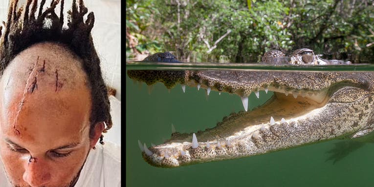 Belize Spearfisherman Survives Brutal Crocodile Attack