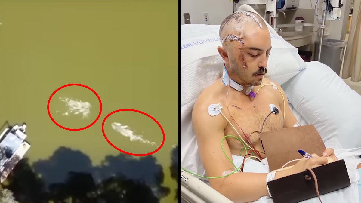 left; alligator swims towards man right; injured man with stitches on head