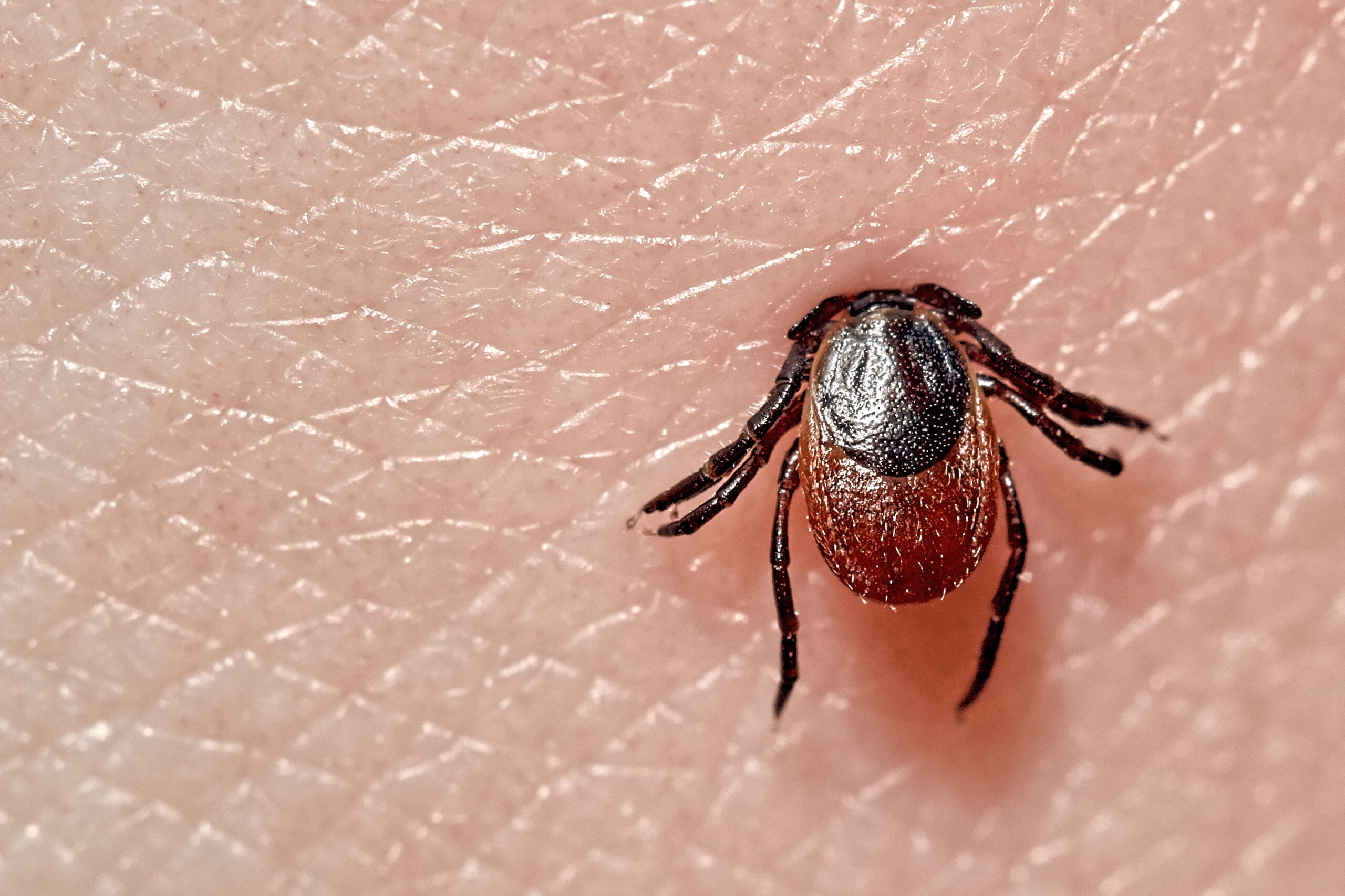 photo of embedded tick