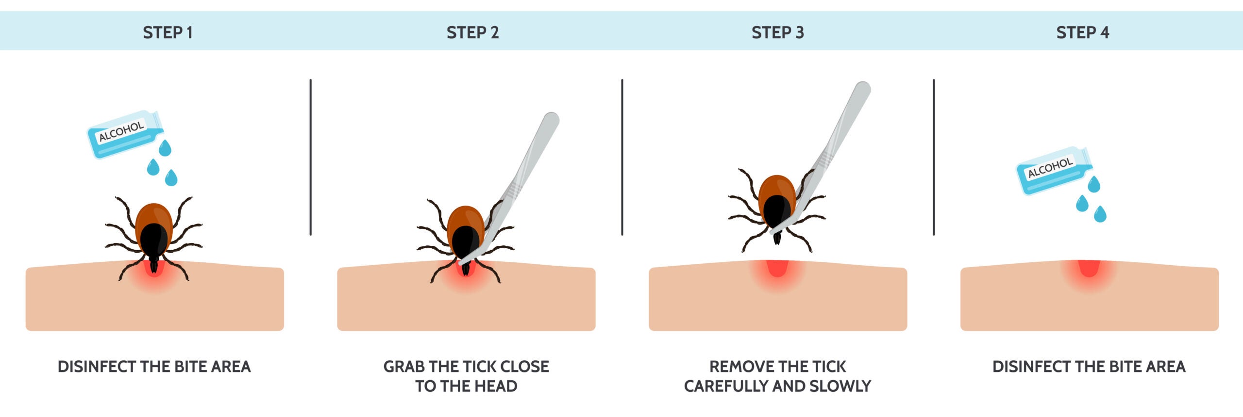 illustration of how to remove a tick
