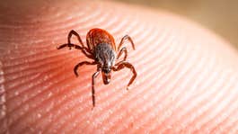 photo of a deer tick crawling on skin